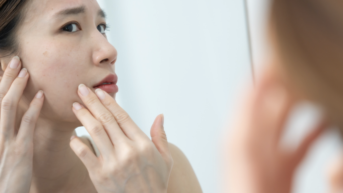 Dermatology Appointment for Eczema and Dry Skin Relief Near Falls Church Virginia